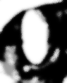 iu_1389341_24746881.png