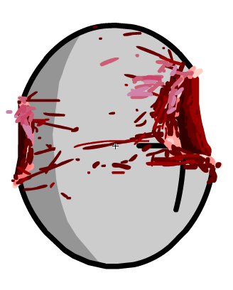iu_1498580_21603057.png